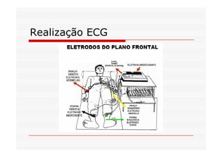 Realização ECG
 