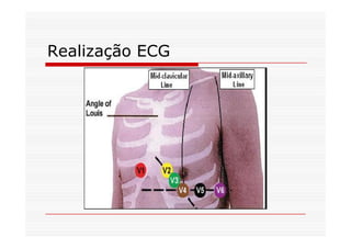 Realização ECG
 