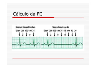 Cálculo da FC
 