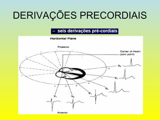 DERIVAÇÕES PRECORDIAIS
 