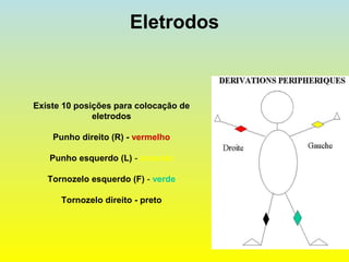 Eletrodos
Existe 10 posições para colocação de
eletrodos
Punho direito (R) - vermelho
Punho esquerdo (L) - amarelo
Tornozelo esquerdo (F) - verde
Tornozelo direito - preto
 
