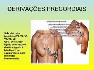 DERIVAÇÕES PRECORDIAIS
Seis eletrodos
torácicos (V1, V2, V3,
V4, V5, V6)
Obs.: O eletrodo
ligado ao tornozelo
direito é ligado à
blindagem do
equipamento, para
minimizar
interferências
 
