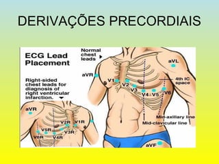 DERIVAÇÕES PRECORDIAIS
 