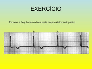 EXERCÍCIO
R R’
Encontre a frequência cardíaca neste traçado eletrocardiográfico
 