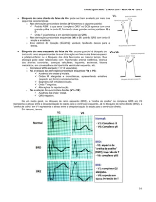 Arlindo Ugulino Netto – CARDIOLOGIA – MEDICINA P6 – 2010.1



      Bloqueio de ramo direito do feixe de His: pode ser bem avaliado por meio das
       seguintes caracter„sticas:
          o Nas deriva‚†es precordiais direitas (V1) teremos o seguinte padrƒo:
               Padrƒo RSR’: o que seria “complexo QRS” no ECG aparece com uma
                   grande quilha na onda R, formando duas grandes ondas positivas: R e
                   R’.
               Onda T assim€trica e em sentido oposto ao QRS.
          o Nas deriva‚†es precordiais esquerdas (V6) e DI: padrƒo QRS com onda S
               ampla e arrastada.
          o Eixo el€trico do cora‚ƒo (S“QRS): vari•vel, tendendo desvio para a
               direita.

      Bloqueio de ramo esquerdo do feixe de His: ocorre quando h• bloqueio do
       tronco do ramo esquerdo antes da sua bifurca‚ƒo em fasc„culos Šntero-superior
       e p…stero-inferior ou o bloqueio dos dois fasc„culos ao mesmo tempo. Sua
       etiologia pode estar relacionada com: hipertensƒo arterial sistˆmica, doen‚a
       das art€rias coron•rias, doen‚as valvulares, isquemia, esclerose, fatores
       mecŠnicos, em conseq‘ˆncia da hipertrofia ventricular esquerda, etc.
            o Complexo QRS alargado (> 0,12 segundos).
            o Na avalia‚ƒo das deriva‚†es precordiais esquerdas (V5 e V6):
                    Ausˆncia de ondas q iniciais.
                    Ondas R alargadas e monof•sicas, apresentando entalhes
                       (aspecto em torre) e empastamentos.
                    Segmento ST infradesnivelado.
                    Onda T negativa.
                    Altera‚†es da repolariza‚ƒo.
           o Na avalia‚ƒo das precordiais direitas (V1 e V2):
                    Ausˆncia da onda r inicial.
                    QRS negativo.

        De um modo geral, no bloqueio de ramo esquerdo (BRE), a “orelha de coelho” no complexo QRS em V6
representa o atraso entre a despolariza‚ƒo do septo para o ventr„culo esquerdo. J• no bloqueio de ramo direito (BRD), a
“orelha de colho” em V1 representa o atraso entre a despolariza‚ƒo do septo para o ventr„culo direito.
        Em resumo, temos:




                                                                                                                        16
 