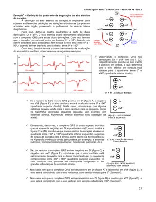 Arlindo Ugulino Netto – CARDIOLOGIA – MEDICINA P6 – 2010.1

         1
Exemplo – Defini•‚o do quadrante de angula•‚o do eixo el‹trico
do cora•‚o.
        A definição do eixo elétrico do coração é importante para
observar e diferenciar patologias ou variações anatômicas que possam
acometer este órgão, prevenindo o profissional de realizar falsos
diagnósticos.
        Para isso, define-se quatro quadrantes a partir de duas
derivações: DI e aVF. O eixo elétrico estará diretamente relacionado
com o complexo QRS para essas duas derivações. Com isso, tem-se
que o coração normal está entre os ângulos 0º e 90º. Quando ele
estiver desviado para a esquerda, tem-se que o eixo está entre 0º a -
90º, e quando estiver desviado para a direita, entre 0º e 180º.
        Com isso, para iniciarmos o nosso treinamento de localização
do eixo elétrico cardíaco, observaremos os seguintes exemplos:

                                                                                 Observando o complexo QRS nas
                                                                                  derivações DI e aVF em (A) e (D),
                                                                                  respectivamente, conclui-se que o QRS
                                                                                  é positivo em ambos, o que determina
                                                                                  que o eixo elétrico do coração está
                                                                                                                     o
                                                                                  voltado para o quadrante entre 0 e
                                                                                  +90º (quadrante inferior direito).




              Se o registro do ECG mostra QRS positivo em DI (figura A) e negativo
                                                                           o      o
               em aVF (figura F), o eixo cardíaco estará localizado entre 0 e -90
               (quadrante superior direito). Neste caso, considera-se que alguma
               patologia desviou ainda mais o eixo cardíaco para a esquerda, como
               na hipertrofia ventricular esquerda (causada, por exemplo, por
               estenose aórtica, hipertensão arterial sistêmica e/ou coartação da
               aorta).


              Observando, desta vez, o complexo QRS de outro suposto indivíduo
               que se apresenta negativo em DI e positivo em aVF, como mostra a
               figura (C) e (D), conclui-se que o eixo elétrico do coração situa-se no
               quadrante entre +90º e 180º (quadrante inferior esquerdo), sugestivo
               de desvio do coração para a direita, como ocorre na dextrocardia ou
               na hipertrofia ventricular direita (secundária, por exemplo, a estenose
               pulmonar, tromboembolismo pulmonar, hipertensão pulmonar, etc.).


              Se, por ventura, o complexo QRS estiver negativo em DI (figura C) e
               negativo em aVF (figura F), conclui-se que o eixo cardíaco está
               extremamente desviado para a direta, localizando-se no quadrante
               compreendido entre -90º e 180º (quadrante superior esquerdo). É
               uma condição rara, presente em cardiopatias congênitas ou em
               grandes sobrecargas do ventrículo direito.

              Nos casos em que o complexo QRS estiver positivo em DI (figura A) e isoelétrico em aVF (figura E), o
                                                                                        o
               eixo estará coincidindo com o eixo horizontal, com sentido voltado para 0 (Exemplo²).

              Nos casos em que o complexo QRS estiver isoelétrico em DI (figura B) e positivo em aVF (figura D), o
                                                                                                  8
               eixo estará coincidindo com o eixo vertical, com sentido voltado para +90º (Exemplo ).


                                                                                                                          23
 