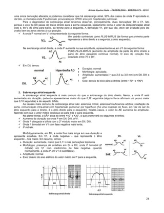 Arlindo Ugulino Netto – CARDIOLOGIA – MEDICINA P6 – 2010.1


uma ‹nica deriva‚ƒo alterada j• podemos considerar que h• sobrecarga atrial. 90% dos casos de onda P apiculada €,
de fato, a chamada onda P pulmonale, provocada por DPOC e/ou por hipertensƒo pulmonar.
         Para o diagn…stico de sobrecarga atrial devemos observar, principalmente, duas deriva‚†es: DII e V1. Isto
porque o eixo de DII passa do bra‚o direito para a perna esquerda, exatamente como o vetor da despolariza‚ƒo atrial
(isto €, 60˜): de cima para baixo, da direita para a esquerda. A deriva‚ƒo V1, por sua vez, deve ser avaliada pois ela
avalia bem os •trios devido ‰ sua posi‚ƒo.
      A onda P normal em V1 € representada da seguinte forma:
                                                 Um padrƒo conhecido como PLUS-MINUS (de forma que primeira parte
                                                 representa o •trio direito e a segunda, o •trio esquerdo).


       Na sobrecarga atrial direita, a onda P aumenta na sua amplitude, apresentando-se em V1 da seguinte forma:
                                                PLUS-PLUS-MINUS (aumento da amplitude da parte do •trio direito e
                                                parte do •trio esquerdo continua normal). O eixo do cora‚ƒo fica
                                                desviado entre 70 e 90˜.


      Em DII, temos:
                                                          Dura‚ƒo: normal
                                                          Morfologia: apiculada.
                                                          Amplitude: aumentada (> que 2,5 ou 3,0 mm) em DII, DIII e
                                                           aVF
                                                          Eixo: desvio do eixo para a direita (entre +70’ e +90’)



     2. Sobrecarga atrial esquerda
        A sobrecarga atrial esquerda € mais comum do que a sobrecarga do •trio direito. Nesta, a onda P est•
aumentada em dura‚ƒo, podendo apresentar-se maior do que 0,12 segundos (alguns livros afirmam um pouco maior
que 0,10 segundos) e de aspecto b„fido.
        As causas mais comuns de sobrecarga atrial sƒo: estenose mitral; estenose/insuficiencia a…rtica; coarta‚ƒo da
aorta, comunica‚ƒo intra-atrial com hipertensƒo pulmonar por hiperfluxo (h• uma inversƒo do fluxo, em vez de ser do
•trio esquerdo para o direito, € o •trio direito para o esquerdo). Nestes casos, o vetor do AE aumenta de amplitude,
fazendo com que o vetor m€dio desloque-se para tr•s e para esquerda.
        No plano frontal, o S“P situa-se entre +40˜ e +20˜, o que promover• os seguintes eventos:
      Aumento da dura‚ƒo da onda P em DII, DIII, aFV;
      Onda P alargada e b„fida com o 2’ m…dulo maior em DII, DIII;
      Onda P bimodal em V1 com fase negativa mais lenta;
      P mitrale.

       Morfologicamente, em DII, a onda fica mais longa em sua dura‚ƒo e
apresenta entalhes. Em V1, a onda negativa – que representa o •trio
esquerdo – fica maior. Em resumo, temos:
      Dura‚ƒo: aumentada, maior que 0,11 s nas deriva‚†es bipolares
      Morfologia: presen‚a de entalhes em DI e DII; onda P bimodal (P
         mitrale) em V1 com predom„nio da fase negativa (quando
         normalmente, a onda P em V1 € isodif•sica).
      Amplitude: normal
      Eixo: desvio do eixo el€trico do vetor m€dio de P para a esquerda.




                                                                                                                       28
 