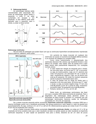 Arlindo Ugulino Netto – CARDIOLOGIA – MEDICINA P6 – 2010.1


     3. Sobrecarga biatrial
         As sobrecargas biatriais serƒo
caracterizadas pela associa‚ƒo dos
sinais de sobrecargas atriais direita e
esquerda: a onda P vai estar
aumentada       em     dura‚ƒo e em
amplitude. O eixo el€trico pode estar
desviado para a esquerda, para a
direita, ou estar na faixa normal.




Sobrecarga ventricular.
         H• uma s€rie de patologias que podem fazer com que os ventr„culos hipertrofiem simultaneamente: hipertensƒo
arterial sistˆmica, atletismo, entre outras.
                                                               Um aumento da massa muscular em qualquer dos
                                                      ventr„culos vai causar um aumento da atividade el€trica card„aca
                                                      e um aumento da voltagem do complexo QRS.
                                                               Como vimos anteriormente, a despolariza‚ƒo dos
                                                      ventr„culos descreve trˆs vetores cuja resultante fornece o eixo
                                                      el€trico do cora‚ƒo: vetor septal, vetor de parede livre e vetor
                                                      basal (sendo este praticamente desprez„vel). Em condi‚†es
                                                      normais, temos:
                                                            O vetor septal tem dire‚ƒo da esquerda para a direita,
                                                               de cima para baixo, de forma que V1 “vˆ” a sua ponta,
                                                               ou seja, se mostra positivo. Logo, em V1, teremos uma
                                                               onda r (R pequena). J• a deriva‚ƒo V6 “vˆ” a cauda do
                                                               vetor, mostrando-se negativo. Logo, em V6 temos uma
                                                               onda q (Q pequena). As ondas se mostram pequenas
                                                               devido ‰ pequena intensidade deste vetor.
                                                           O vetor de parede livre se dirige da direita para a
                                                               esquerda e de cima para baixo, de forma que V1 “veja”
                                                               a cauda, ou seja, se mostre negativo (logo, V1 tem uma
                                                               onda S grande); j• V6 “vˆ” a ponta do vetor, mostrando-
                                                               se positivo (logo, V6 apresenta uma onda R grande).
                                                           Portanto, temos em V1: rS e, em V2: qR.

                                                                Deste modo, as sobrecargas ventriculares vƒo fazer
                                                       com que o complexo QRS altere (aumente) de amplitude. Para o
                                                       diagn…stico das sobrecargas atriais devemos avaliar as
                                                       deriva‚†es do plano frontal (e tamb€m V1), enquanto que nas
                                                       sobrecargas ventriculares devemos avaliar as deriva‚†es
                                                       precordiais (V1, V5 e V6, em especial).
        Se a massa muscular esquerda estiver aumentada (hipertrofia ventricular esquerda) o complexo QRS tem a
mesma morfologia, por€m com a amplitude aumentada. Isto porque predomina o vetor septal e o vetor de parede livre
exacerbadamente. Ou seja, continua o rS em V1 e o qR em V6, diferenciando-se apenas por ondas S (em V1) e ondas
R (em V6) de amplitudes bem maiores.
        J• se a massa muscular direita estiver aumentada (hipertrofia ventricular direita), as ondas em V1 e V6 se
mostrarƒo de forma contr•ria (visto que o vetor resultante vai estar no sentido oposto ao vetor resultante na hipertrofia
ventircular esquerda). O vetor septal vai apresentar mais para a direita, deixando de ser um vetor de pouca

                                                                                                                         29
 