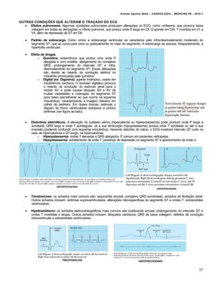 Arlindo Ugulino Netto – CARDIOLOGIA – MEDICINA P6 – 2010.1


OUTRAS CONDIÇÕES QUE ALTERAM O TRAÇADO DO ECG
   Efeitos pulmonares. Algumas condições pulmonares produzem alterações no ECG, como: enfisema, que provoca baixa
     voltagem em todas as derivações; e infarto pulmonar, que produz onda S larga em DI, Q grande em DIII, T invertida em V1 a
     V4, além de depressão de ST em DII.

       Padrão de sobrecarga. Como vimos a sobrecarga ventricular se caracteriza pelo infra-desnivelamento moderado do
        segmento ST, que se curva para cima ou gradualmente no meio do segmento. A sobrecarga se associa, frequentemente, à
        hipertrofia ventricular.

       Efeito de drogas.
             o Quinidina: antiarrítmico que produz uma onda P
                 alargada e com entalhe, alargamento do complexo
                 QRS, prolongamento do intervalo QT e infra-
                 desnivelamento do segmento ST. Essas alterações
                 são devido ao retardo da condução elétrica no
                 miocárdio provocadas pela quinidina.
             o Digital (ex: Digoxina): agente inotrópico, usado em
                 insuficiência cardíaca. O excesso digitálico provoca
                 o retardo na condução do estímulo atrial para o
                 nódulo AV e pode causar bloqueio SA e AV de
                 muitas variedades e inclinação do segmento ST
                 para baixo (semelhante ao que ocorre na isquemia
                 miocárdica), caracterizando a imagem clássica em
                 colher de pedreiro. Em doses tóxicas, estimula o
                 disparo de focos ventriculares ectópicos e produz
                 arritmias (ver figura ao lado).


       Distúrbios eletrolíticos. A elevação do potássio sérico (hipercalemia ou hiperpotassemia) pode produzir onda P larga e
        achatada, QRS largo e onda T pontiaguda. Já a sua diminuição (hipopotassemia) produz onda T achatada ou até a sua
        inversão (podendo confundir com isquemia miocárdica). Havendo distúrbio do cálcio, o ECG mostrará intervalo QT curto no
        caso de hipercalcemia e QT longo, na hipercalcemia.
            o Hiperpotassemia: ondas T elevadas e QRS alargados. É comum em pacientes nefropatas.
            o Hipopotassemia: achatamento da onda T, presença de depressão no segmento ST e aparecimento da onda U.




       Tireotoxicose: os achados mais comuns são: taquicardia sinusal, complexo QRS aumentado, achados de fibrilação atrial.
        Outros achados incluem: arritmias supraventriculares, alterações não-específicas do segmento ST e ondas T, extrasístoles
        ventriculares.

       Hipotireoidismo: os achados eletrocardiográficos mais comuns são bradicardia sinusal, prolongamento do intervalo QT e
        ondas T invertidas e largas. Outros achados incluem: bloqueios cardíacos, QRS de baixa voltagem, defeitos de condução
        intraventricular e extrasístoles ventriculares.




                                                                                                                               35
 