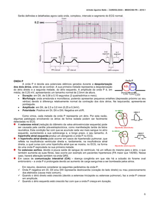 Arlindo Ugulino Netto – CARDIOLOGIA – MEDICINA P6 – 2010.1


   Serƒo definidas e detalhadas agora cada onda, complexo, intervalo e segmento do ECG normal.




ONDA P
        A onda P € devida aos potenciais el€tricos gerados durante a despolarização
dos dois átrios, antes de se contrair. A sua primeira metade representa a despolariza‚ƒo
do •trio direito e a segunda metade, do •trio esquerdo. A amplitude da onda P €, em
m€dia, de 0.25 mV, apresentando um tamanho normal de 2,5mm de altura.
    Duração: em DII, de 0,08 a 0,10 segundos (2 quadradinhos e meio).
    Morfologia: onda arredonda e monof•sica, podendo apresentar pequenos entalhes (depressƒo pr…ximo ao seu
        v€rtice) devido ‰ diferen‚a relativamente normal da contra‚ƒo dos dois •trios. Na taquicardia, apresenta-se
        pontiaguda.
    Amplitude: em DII, de 2,5 a 3,0 mm (0,25 a 0,3mV).
    Polaridade: Positiva em DI, DII e DIII. Negativa em aVR.

         Como vimos, cada metade da onda P representa um •trio. Por esta razƒo,
algumas patologias envolvendo os •trios de forma isolada podem ser facilmente
detectadas no ECG.
    A estenose mitral (redu‚ƒo do diŠmetro da valva atriovetrnciular esquerda) pode
    ser causada pela cardite p…s-estreptoc…cica, como manifesta‚ƒo tardia da febre
    reum•tica. Esta condi‚ƒo faz com que se acumule cada vez mais sangue no atrio
    esquerdo, aumentando a sua sobrecarga e, a longo prazo, o seu tamanho. A
    hipertrofia atrial esquerda produz um alongando a onda P no ECG.
    A hipertrofia atrial direita pode ocorrer em casos de hipertensƒo pulmonar, que
    reflete na insuficiˆncia ventricular direita e, tardiamente, na insuficiˆncia atrial
    direita, a qual cursa com uma hipertrofia atrial que se mostra, no ECG, na forma
    de uma onda P espiculada na sua primeira metade.
    Na estenose aortica, devido ‰ pouca sa„da de sangue do ventr„culo, h• um refluxo do mesmo para o •trio, o que
    tamb€m aumenta as suas fibras. Isso ocorre por exemplo em pacientes hipertensos (PA maior que 140/90). Nesse
    caso, haver• altera‚ƒo tamb€m na onda QRS.
    Em casos de comunicação interatrial (CIA) – doen‚a congˆnita em que nƒo h• a oclusƒo do forame oval
    embrion•rio – a onda P € prolongada devido ao aumento de carga sangu„nea a ser bombeada pelos atrios.

       Em resumo, devemos considerar os seguintes parŠmetros da onda P:
      Onda P negativa em DI, DII e/ou DIII representa dextrocardia (cora‚ƒo do lado direito) ou mau posicionamento
       dos eletrodos (causa mais comum).
      Quando o •trio direito est• crescido (devido a estenose tric‹spide ou estenose pulmonar), faz a onda P crescer
       em amplitude.
      Quando o •trio esquerdo est• crescido faz com que a onda P cres‚a em dura‚ƒo.




                                                                                                                        6
 