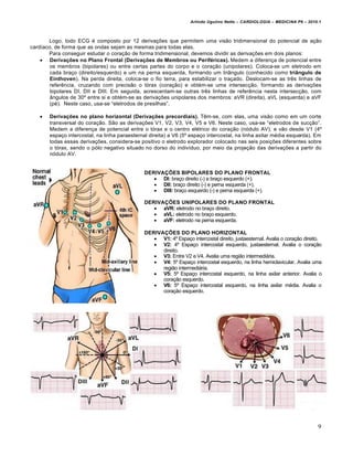 Arlindo Ugulino Netto – CARDIOLOGIA – MEDICINA P6 – 2010.1



       Logo, todo ECG € composto por 12 deriva‚†es que permitem uma visƒo tridimensional do potencial de a‚ƒo
card„aco, de forma que as ondas sejam as mesmas para todas elas.
       Para conseguir estudar o cora‚ƒo de forma tridimensional, devemos dividir as deriva‚†es em dois planos:
     Derivações no Plano Frontal (Derivações de Membros ou Periféricas). Medem a diferen‚a de potencial entre
        os membros (bipolares) ou entre certas partes do corpo e o cora‚ƒo (unipolares). Coloca-se um eletrodo em
        cada bra‚o (direito/esquerdo) e um na perna esquerda, formando um triŠngulo (conhecido como triângulo de
        Einthoven). Na perda direita, coloca-se o fio terra, para estabilizar o tra‚ado. Deslocam-se as trˆs linhas de
        referˆncia, cruzando com precisƒo o t…rax (cora‚ƒo) e obt€m-se uma intersec‚ƒo, formando as deriva‚†es
        bipolares DI, DII e DIII. Em seguida, acrescentam-se outras trˆs linhas de referˆncia nesta intersec‚ƒo, com
        Šngulos de 30’ entre si e obt€m-se as deriva‚†es unipolares dos membros: aVR (direita), aVL (esquerda) e aVF
        (p€). Neste caso, usa-se “eletrodos de presilhas”.

      Derivações no plano horizontal (Derivações precordiais). Tˆm-se, com elas, uma visƒo como em um corte
       transversal do cora‚ƒo. Sƒo as deriva‚†es V1, V2, V3, V4, V5 e V6. Neste caso, usa-se “eletrodos de suc‚ƒo”.
       Medem a diferen‚a de potencial entre o t…rax e o centro el€trico do cora‚ƒo (n…dulo AV), e vƒo desde V1 (4’
       espa‚o intercostal, na linha paraesternal direita) a V6 (5’ espa‚o intercostal, na linha axilar m€dia esquerda). Em
       todas essas deriva‚†es, considera-se positivo o eletrodo explorador colocado nas seis posi‚†es diferentes sobre
       o t…rax, sendo o p…lo negativo situado no dorso do indiv„duo, por meio da proje‚ƒo das deriva‚†es a partir do
       n…dulo AV.


                                               DERIVAÇÕES BIPOLARES DO PLANO FRONTAL
                                                   DI: bra‚o direito (-) e bra‚o esquerdo (+).
                                                   DII: bra‚o direito (-) e perna esquerda (+).
                                                   DIII: bra‚o esquerdo (-) e perna esquerda (+).

                                               DERIVAÇÕES UNIPOLARES DO PLANO FRONTAL
                                                   aVR: eletrodo no bra‚o direito.
                                                   aVL: eletrodo no bra‚o esquerdo.
                                                   aVF: eletrodo na perna esquerda.

                                               DERIVAÇÕES DO PLANO HORIZONTAL
                                                   V1: 4’ Espa‚o intercostal direito, justaesternal. Avalia o cora‚ƒo direito.
                                                   V2: 4’ Espa‚o intercostal esquerdo, justaesternal. Avalia o cora‚ƒo
                                                     direito.
                                                   V3: Entre V2 e V4. Avalia uma regiƒo intermedi•ria.
                                                   V4: 5’ Espa‚o intercostal esquerdo, na linha hemiclavicular. Avalia uma
                                                     regiƒo intermedi•ria.
                                                   V5: 5’ Espa‚o intercostal esquerdo, na linha axilar anterior. Avalia o
                                                     cora‚ƒo esquerdo.
                                                   V6: 5’ Espa‚o intercostal esquerdo, na linha axilar m€dia. Avalia o
                                                     cora‚ƒo esquerdo.




                                                                                                                             9
 