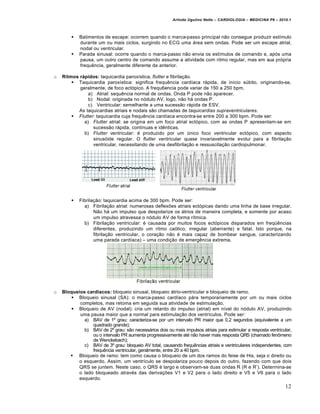 Arlindo Ugulino Netto – CARDIOLOGIA – MEDICINA P6 – 2010.1





o

Ritmos rápidos: taquicardia parox„stica, flutter e fibrila‚ƒo.
 Taquicardia parox„stica: significa frequˆncia card„aca r•pida, de in„cio s‹bito, originando-se,
geralmente, de foco ect…pico. A frequ6encia pode variar de 150 a 250 bpm.
a) Atrial: sequˆncia normal de ondas. Onda P pode nƒo aparecer.
b) Nodal: originada no n…dulo AV, logo, nƒo h• ondas P.
c) Ventricular: semelhante a uma sucessƒo r•pida de ESV.
As taquicardias atriais e nodais sƒo chamadas de taquicardias supraventriculares.
 Flutter: taquicardia cuja frequˆncia card„aca encontra-se entre 200 a 300 bpm. Pode ser:
a) Flutter atrial: se origina em um foco atrial ect…pico, com as ondas P apresentam-se em
sucessƒo r•pida, cont„nuas e idˆnticas.
b) Flutter ventricular: € produzido por um ‹nico foco ventricular ect…pico, com aspecto
sinus…ide regular. O flutter ventricular quase invariavelmente evolui para a fibrila‚ƒo
ventricular, necessitando de uma desfibrila‚ƒo e ressuscita‚ƒo cardiopulmonar.



o

Batimentos de escape: ocorrem quando o marca-passo principal nƒo consegue produzir est„mulo
durante um ou mais ciclos, surgindo no ECG uma •rea sem ondas. Pode ser um escape atrial,
nodal ou ventricular.
Parada sinusal: ocorre quando o marca-passo nƒo envia os est„mulos de comando e, ap…s uma
pausa, um outro centro de comando assume a atividade com ritmo regular, mas em sua pr…pria
frequˆncia, geralmente diferente da anterior.

Fibrila‚ƒo: taquicardia acima de 300 bpm. Pode ser:
a) Fibrila‚ƒo atrial: numerosas deflex†es atriais ect…picas dando uma linha de base irregular.
Nƒo h• um impulso que despolarize os •trios de maneira completa, e somente por acaso
um impulso atravessa o n…dulo AV de forma r„tmica.
b) Fibrila‚ƒo ventricular: € causada por muitos focos ect…picos disparados em freq‘ˆncias
diferentes, produzindo um ritmo ca…tico, irregular (aberrante) e fatal. Isto porque, na
fibrila‚ƒo ventricular, o cora‚ƒo nƒo € mais capaz de bombear sangue, caracterizando
uma parada card„aca) – uma condi‚ƒo de emergˆncia extrema.

Bloqueios cardíacos: bloqueio sinusal, bloqueio •trio-ventricular e bloqueio de ramo.
 Bloqueio sinusal (SA): o marca-passo card„aco p•ra temporariamente por um ou mais ciclos
completos, mas retoma em seguida sua atividade de estimula‚ƒo.
 Bloqueio de AV (nodal): cria um retardo do impulso (atrial) em n„vel do n…dulo AV, produzindo
uma pausa maior que a normal para estimula‚ƒo dos ventr„culos. Pode ser:
a) BAV de 1’ grau: caracteriza-se por um intervalo PR maior que 0,2 segundos (equivalente a um
quadrado grande);
b) BAV de 2’ grau: sƒo necess•rios dois ou mais impulsos atriais para estimular a resposta ventricular,
ou o intervalo PR aumenta progressivamente at€ nƒo haver mais resposta QRS (chamado fen‡meno
de Wenckebach);
c) BAV de 3’ grau: bloqueio AV total, causando frequˆncias atriais e ventriculares independentes, com
frequˆncia ventricular, geralmente, entre 20 a 40 bpm.
 Bloqueio de ramo: tem como causa o bloqueio de um dos ramos do feixe de His, seja o direito ou
o esquerdo. Assim, um ventr„culo se despolariza pouco depois do outro, fazendo com que dois
QRS se juntem. Neste caso, o QRS € largo e observam-se duas ondas R (R e R’). Determina-se
o lado bloqueado atrav€s das deriva‚†es V1 e V2 para o lado direito e V5 e V6 para o lado
esquerdo.

12

 