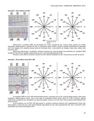 Arlindo Ugulino Netto – CARDIOLOGIA – MEDICINA P6 – 2010.1

6

Exemplo – Eixo el‹trico em 60Œ.

Observando o complexo QRS nas derivações D1 e aVF, percebe-se que, mesmo sendo positivo em ambas
derivações (determinando a posição do eixo no quadrante inferior direito), devido à grande positividade da derivação
aVF com relação à DI, podemos prever parte da conclusão final: o eixo elétrico do coração, neste caso, estará mais
próximo à aVF.
Depois de determinado o quadrante, devemos observar por uma derivação que apresente um complexo QRS
isoelétrico. No ECG em questão, observamos em aVL, cujo vetor perpendicular é DII.
o
Portanto, o eixo elétrico cardíaco coincide com DII, estando localizado em 60 , mais próximo de aVF do que DI.
7

Exemplo – Eixo el‹trico entre 60Œ e 90Œ.

O complexo QRS em aVF está extremamente positivo, enquanto que em DI, embora esteja positivo, está quase
o
isoelétrico. Determinamos, assim, que o eixo está no quadrante inferior direito (entre 0 e 90º). Contudo, apenas
observando a amplitude dos complexos nas duas derivações, veremos, ao final, que o eixo cardíaco está localizado bem
próximo à aVF.
Como podemos ver no ECG, DIII está positivo e, portanto, podemos observar aVL imediatamente. Como aVL
está negativo, conclui-se que o eixo está localizado logo abaixo de seu vetor perpendicular DII, isto é: entre 60º e 90º,
justificando sua maior proximidade à aVF.

26

 