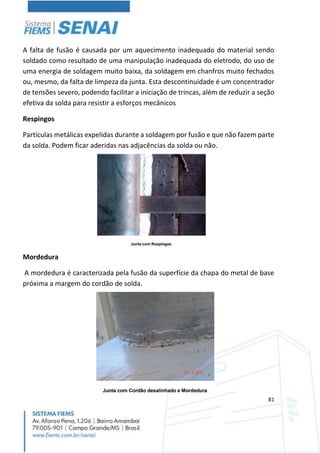 81
A falta de fusão é causada por um aquecimento inadequado do material sendo
soldado como resultado de uma manipulação inadequada do eletrodo, do uso de
uma energia de soldagem muito baixa, da soldagem em chanfros muito fechados
ou, mesmo, da falta de limpeza da junta. Esta descontinuidade é um concentrador
de tensões severo, podendo facilitar a iniciação de trincas, além de reduzir a seção
efetiva da solda para resistir a esforços mecânicos
Respingos
Partículas metálicas expelidas durante a soldagem por fusão e que não fazem parte
da solda. Podem ficar aderidas nas adjacências da solda ou não.
Mordedura
A mordedura é caracterizada pela fusão da superfície da chapa do metal de base
próxima a margem do cordão de solda.
 