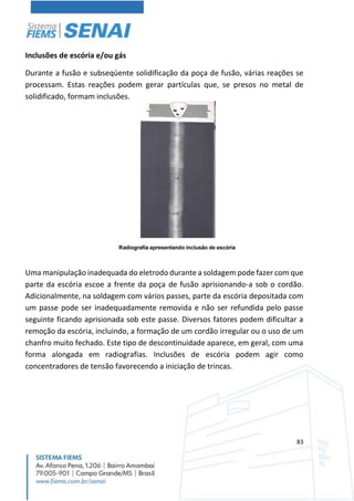 83
Inclusões de escória e/ou gás
Durante a fusão e subseqüente solidificação da poça de fusão, várias reações se
processam. Estas reações podem gerar partículas que, se presos no metal de
solidificado, formam inclusões.
Uma manipulação inadequada do eletrodo durante a soldagem pode fazer com que
parte da escória escoe a frente da poça de fusão aprisionando-a sob o cordão.
Adicionalmente, na soldagem com vários passes, parte da escória depositada com
um passe pode ser inadequadamente removida e não ser refundida pelo passe
seguinte ficando aprisionada sob este passe. Diversos fatores podem dificultar a
remoção da escória, incluindo, a formação de um cordão irregular ou o uso de um
chanfro muito fechado. Este tipo de descontinuidade aparece, em geral, com uma
forma alongada em radiografias. Inclusões de escória podem agir como
concentradores de tensão favorecendo a iniciação de trincas.
 