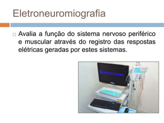 Eletroneuromiografia
 Avalia a função do sistema nervoso periférico
e muscular através do registro das respostas
elétricas geradas por estes sistemas.
 