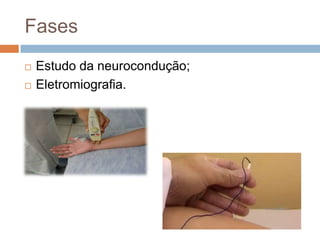 Fases
 Estudo da neurocondução;
 Eletromiografia.
 
