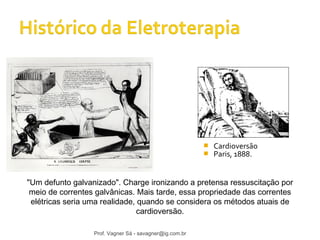  Cardioversão 
 Paris, 1888. 
"Um defunto galvanizado". Charge ironizando a pretensa ressuscitação por 
meio de correntes galvânicas. Mais tarde, essa propriedade das correntes 
elétricas seria uma realidade, quando se considera os métodos atuais de 
cardioversão. 
Prof. Vagner Sá - savagner@ig.com.br 
 