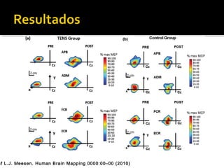 Raf L.J. Meesen. Human Brain Mapping 0000:00–00 (2010) 
 