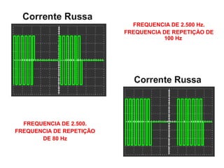 FREQUENCIA DE 2.500 Hz. 
FREQUENCIA DE REPETIÇÀO DE 
100 Hz 
FREQUENCIA DE 2.500. 
FREQUENCIA DE REPETIÇÃO 
DE 80 Hz 
 