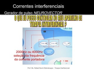 Correntes interferenciais 
Gerador de pulso NEUROVECTOR 
2000Hz ou 4000Hz 
seleção da frequência 
da corrente portadora 
Prof. Ms. Rafael Davini Eletroterapia – Terapia Interferencial 
 