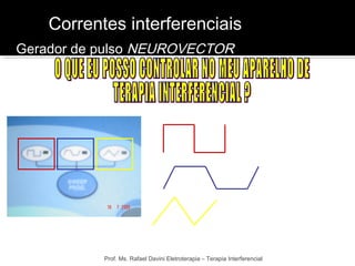 Correntes interferenciais 
Prof. Ms. Rafael Davini Eletroterapia – Terapia Interferencial 
SWEEP 
PROGRAM 
ΔAMF 
Gerador de pulso NEUROVECTOR 
 