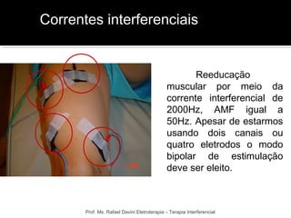 Correntes interferenciais 
Reeducação 
muscular por meio da 
corrente interferencial de 
2000Hz, AMF igual a 
50Hz. Apesar de estarmos 
usando dois canais ou 
quatro eletrodos o modo 
bipolar de estimulação 
deve ser eleito. 
Prof. Ms. Rafael Davini Eletroterapia – Terapia Interferencial 
 