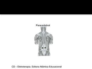 CD – Eletroterapia. Editora Atlântica Educacional 
 