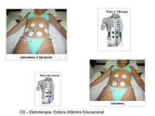 CD – Eletroterapia. Editora Atlântica Educacional 
 