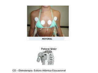 CD – Eletroterapia. Editora Atlântica Educacional 
 