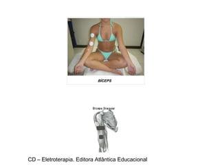 CD – Eletroterapia. Editora Atlântica Educacional 
 