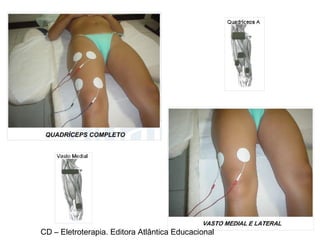 CD – Eletroterapia. Editora Atlântica Educacional 
 