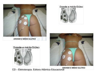 CD – Eletroterapia. Editora Atlântica Educacional 
 