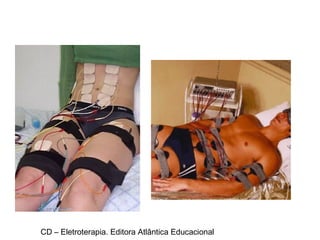 CD – Eletroterapia. Editora Atlântica Educacional 
 