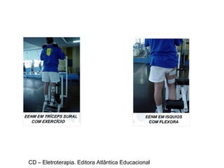 CD – Eletroterapia. Editora Atlântica Educacional 
 