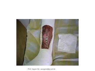 Prof. Vagner Sá - savagner@ig.com.br 
 