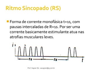 Forma de corrente monofásica t=1s, com 
pausas intercaladas de R=1s. Por ser uma 
corrente basicamente estimulante atua nas 
atrofias musculares leves. 
Prof. Vagner Sá - savagner@ig.com.br 
 