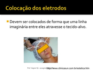 Devem ser colocados de forma que uma linha 
imaginária entre eles atravesse o tecido-alvo. 
Prof. Vagner Sá - savagner@higtt.cpo:m//.wbrww.clinicasun.com.br/estetica.htm 
 