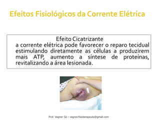 Efeito Cicatrizante
a corrente elétrica pode favorecer o reparo tecidual
estimulando diretamente as células a produzirem
mais ATP, aumento a síntese de proteínas,
revitalizando a área lesionada.
Prof. Vagner Sá – vagner.fisioterapeuta@gmail.com
 