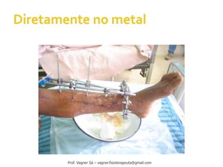 Prof. Vagner Sá – vagner.fisioterapeuta@gmail.com
 