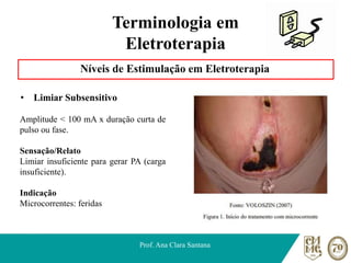 Terminologia em
Eletroterapia
Níveis de Estimulação em Eletroterapia
• Limiar Subsensitivo
Prof. Ana Clara Santana
Amplitude < 100 mA x duração curta de
pulso ou fase.
Sensação/Relato
Limiar insuficiente para gerar PA (carga
insuficiente).
Indicação
Microcorrentes: feridas
 