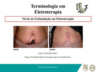 Terminologia em
Eletroterapia
Níveis de Estimulação em Eletroterapia
Prof. Ana Clara Santana
 