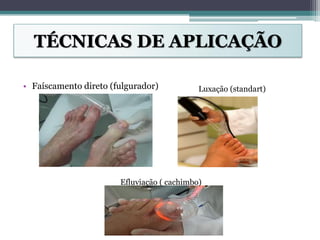 TÉCNICAS DE APLICAÇÃO
• Faíscamento direto (fulgurador) Luxação (standart)
Efluviação ( cachimbo)
 