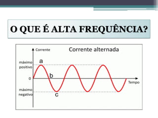 O QUE É ALTA FREQUÊNCIA?
 