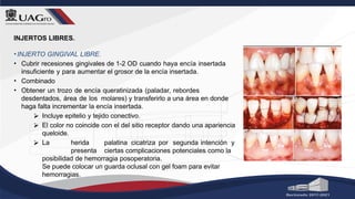 INJERTOS LIBRES.
•INJERTO GINGIVAL LIBRE.
• Cubrir recesiones gingivales de 1-2 OD cuando haya encía insertada
insuficiente y para aumentar el grosor de la encía insertada.
• Combinado
• Obtener un trozo de encía queratinizada (paladar, rebordes
desdentados, área de los molares) y transferirlo a una área en donde
haga falta incrementar la encía insertada.
⮚ Incluye epitelio y tejido conectivo.
⮚ El color no coincide con el del sitio receptor dando una apariencia
queloide.
⮚ La herida palatina cicatriza por segunda intención y
presenta ciertas complicaciones potenciales como la
posibilidad de hemorragia posoperatoria.
Se puede colocar un guarda oclusal con gel foam para evitar
hemorragias.
 