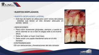 •INJERTOS DESPLAZADOS.
•INJERTO DESPLAZADO LATERAL.
• Este tipo de injerto se utiliza para cubrir raíces denudadas
aisladas que tienen un sitio donador adecuado en
sentido lateral.
•INDICACIONES:
• Para cubrir recesiones gingivales, siempre y cuando la
encía adonde se va a rotar el colgajo esté a una buena
altura.
• Debe de haber un buen nivel óseo.
• Debe existir una papila interdental sana en el sitio
donador.
CONTRAINDICADO
OD con dehiscencias y fenestraciones del sitio donador
 