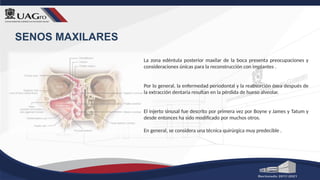 SENOS MAXILARES
La zona edéntula posterior maxilar de la boca presenta preocupaciones y
consideraciones únicas para la reconstrucción con implantes .
Por lo general, la enfermedad periodontal y la reabsorción ósea después de
la extracción dentaria resultan en la pérdida de hueso alveolar.
El injerto sinusal fue descrito por primera vez por Boyne y James y Tatum y
desde entonces ha sido modificado por muchos otros.
En general, se considera una técnica quirúrgica muy predecible .
 