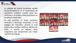 La utilidad del injerto tunelizado estriba
fundamentalmente en el tratamiento de
recesiones múltiples cuando estas son
continuas y no existen malas posiciones en
los dientes implicados.
En este proceder se evitan incisiones
verticales o descargas empleadas en los
colgajos de reposición coronal lo cual
proporciona ventajas estéticas, además de
evitar la sección de algunos vasos
sanguíneos que proporciona una mejor
nutrición del injerto.
 