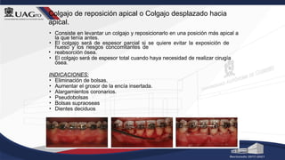 Colgajo de reposición apical o Colgajo desplazado hacia
apical.
• Consiste en levantar un colgajo y reposicionarlo en una posición más apical a
la que tenía antes.
• El colgajo será de espesor parcial si se quiere evitar la exposición de
hueso y los riesgos concomitantes de
• reabsorción ósea.
• El colgajo será de espesor total cuando haya necesidad de realizar cirugía
ósea.
INDICACIONES:
• Eliminación de bolsas.
• Aumentar el grosor de la encía insertada.
• Alargamientos coronarios.
• Pseudobolsas
• Bolsas supraoseas
• Dientes deciduos
 