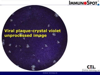  ©Cellular Technology Ltd. Viral plaque-crystal violetunprocessed image